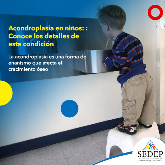 Acondroplasia en niños: Conoce los detalles de esta condición