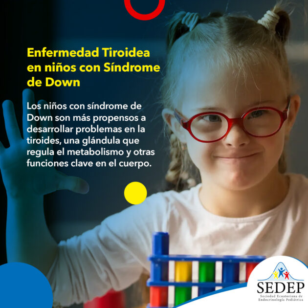 Enfermedad tiroidea en niños con Síndrome de Down