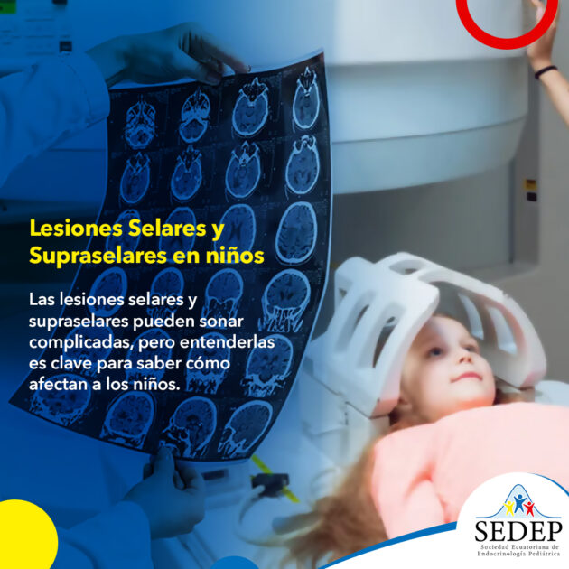 Lesiones Selares y Supraselares en niños