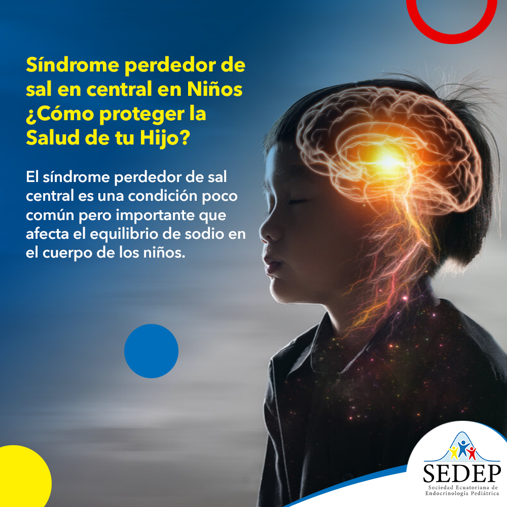 Síndrome Perdedor de Sal Central en Niños: Lo que Necesitas Saber